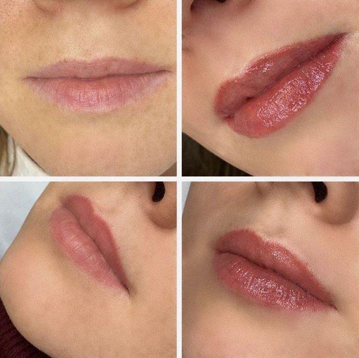 Ako sa pery hoja po tetovaní - Trvalý make -up pier Ako sa pery uzdravujú po tetovaní - Trvalý make -up pier