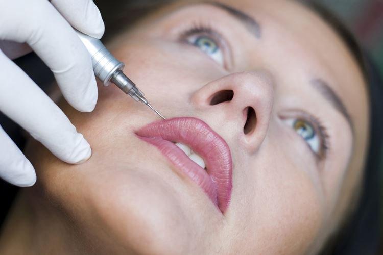 Potrebujem trvalú korekciu makeupu na pery? Potrebujem trvalú korekciu makeupu na pery?