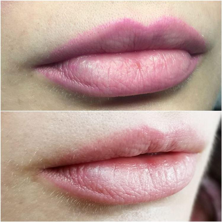 Je možné odstrániť trvalý make -up pier Je možné odstrániť trvalý make -up pier
