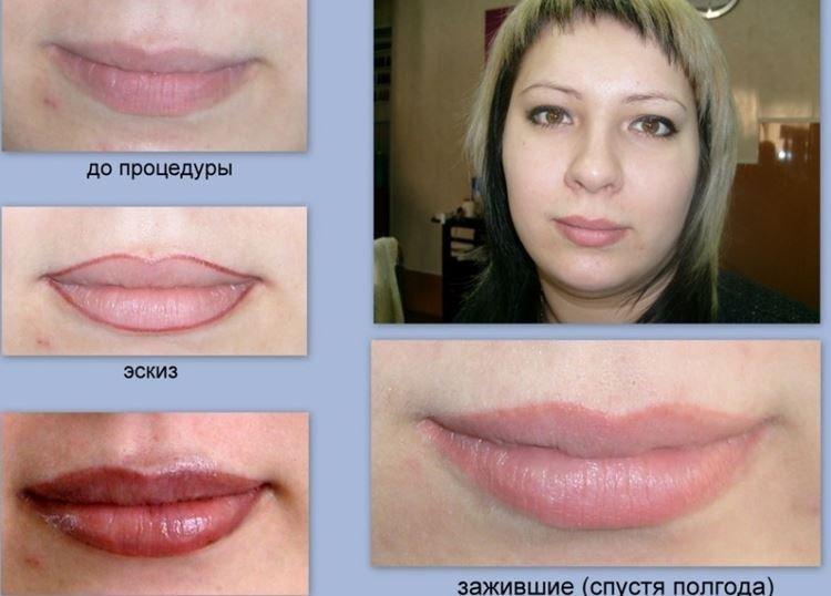 Permanentný makeup na pery - pred a po fotkách Permanentný makeup na pery - pred a po fotkách