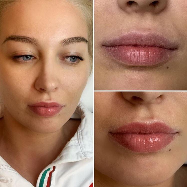 Permanentný makeup na pery - pred a po fotkách Permanentný makeup na pery - pred a po fotkách