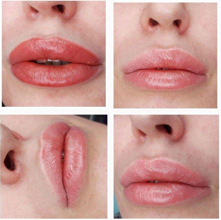 Permanentný makeup na pery - pred a po fotkách Permanentný makeup na pery - pred a po fotkách