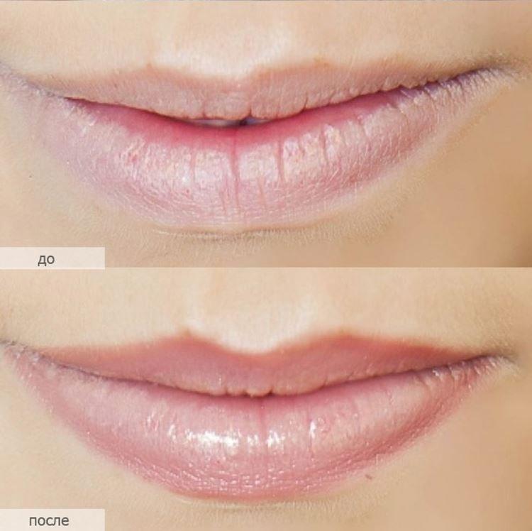 Permanentný makeup na pery - pred a po fotkách Permanentný makeup na pery - pred a po fotkách