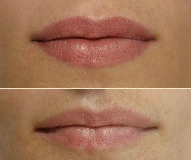 Permanentný makeup na pery - pred a po fotkách Permanentný makeup na pery - pred a po fotkách