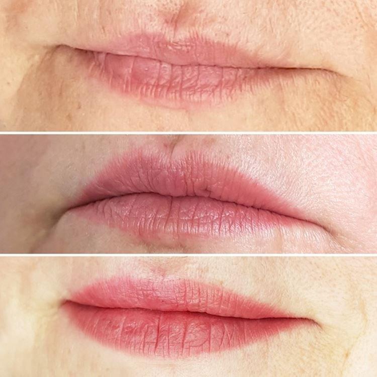 Permanentný makeup na pery - pred a po fotkách Permanentný makeup na pery - pred a po fotkách